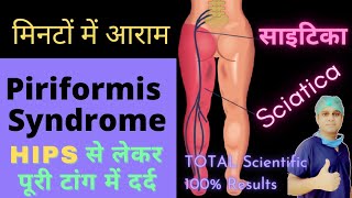 Sciatica dard kaise theek kare | साइटिका दर्द का इलाज | Piriformis Syndrome kya hota hai screenshot 5