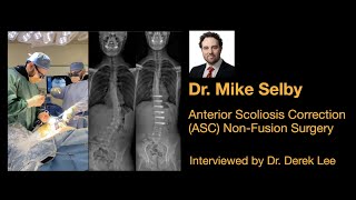 Dr. Mike Selby, Anterior Scoliosis Correction (ASC) Non-Fusion Surgery, by Dr. Derek Lee