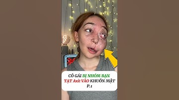 [P.1] Bị bạn học Tạt Axit vào mặt #shorts