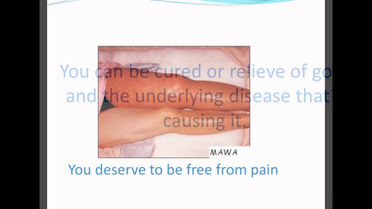 Gout Pain is completely relief upload image