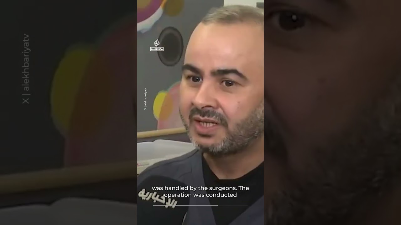 تم فصل توأمين ملتصقين بعد عملية جراحية في السعودية | AJ #shorts