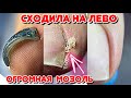 Как убрать подногтевую мозоль 😱 Ногти плюшки 💅 Педикюр