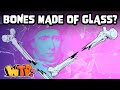 The Glass Delusion Quiz