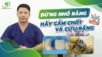 Cắm Chốt Vào Răng Để Giữ Lại Răng Thật - Rẻ Nhưng Hiệu Quả