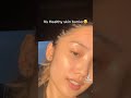 FROM ACNE TO CLEAR SKIN JOURNEY |SKINCARE TIKTOK #SHORTS