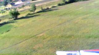 Multiplex acromaster 3