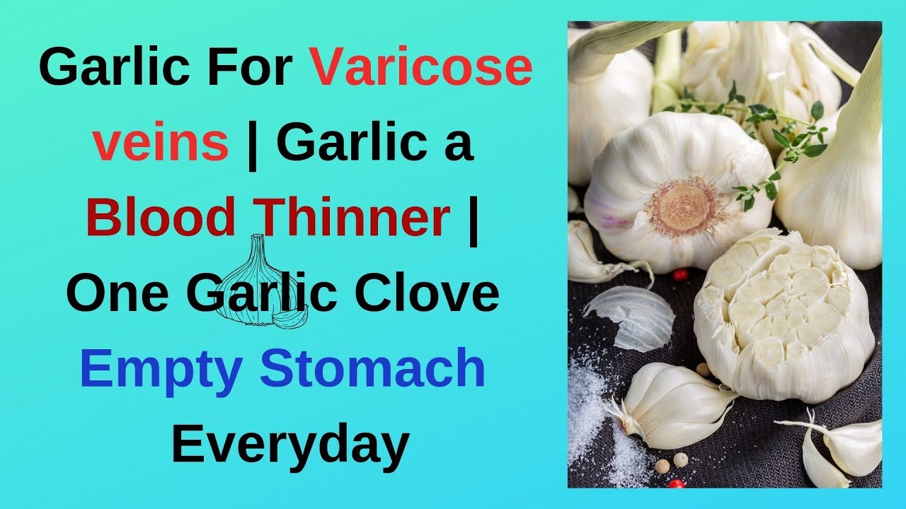 varicose veins treatment homeopathy Garlic for varicose veins | Garlic a natural blood thinner | Garlic for empty stomach everyday