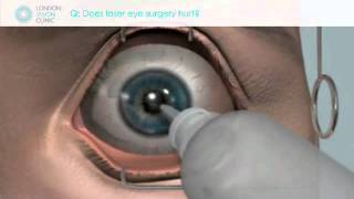 Does laser eye surgery hurt?