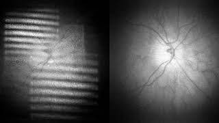 Real-time digital holography of the retina by eigendecomposition.