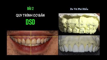 [Digital Smile Design - DSD] Bài 2 - DSD cơ bản trong TH1 | BS Võ Phi Hiếu