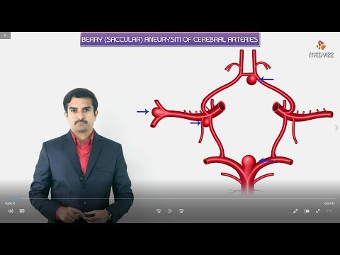 Berry aneurysms (saccular) - Most common sites, Symptoms, Diagnosis and Pathology