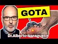 GOTA 💥 Causas, Síntomas y Tratamiento (acido úrico alto)