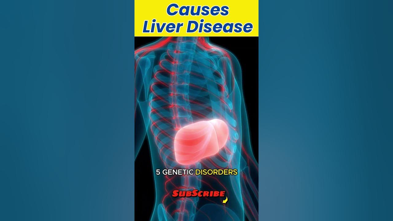 10 common causes of liver disease YouTube