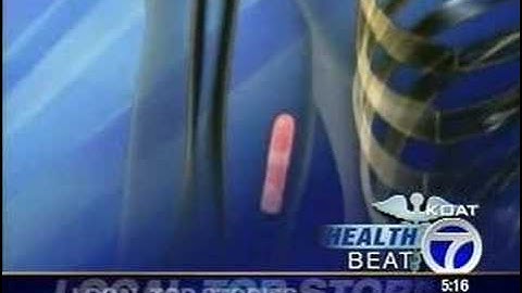 Healthbeat - Tracking Alzheimer