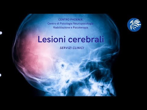 Video: Come gestire il recupero da un trauma cranico (trauma cerebrale)