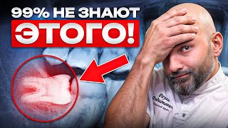 картинка: 🦷 ЗУБЫ МУДРОСТИ - ГЛАВНАЯ УГРОЗА ВАШЕЙ УЛЫБКИ!