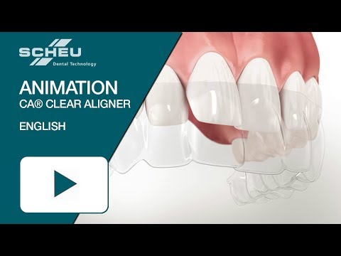 CA® CLEAR ALIGNER Animation (english)