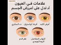 علامات في العيون تدل على أمراض الجسم 