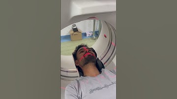 Ct Scan Of 3D Face 💆‍♂️