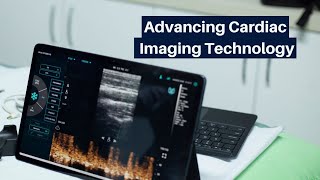 Advancing Cardiac Imaging Technology