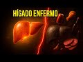 5 SEÑALES de un HÍGADO ENFERMO