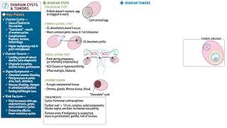 Ovarian cysts and tumors screenshot 1