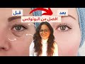 لو عايزه تصغري 10 سنين أسرع طريقه للتخلص من الهالات و الانتفاخات و تهدل منطقه العين دينا حسني 