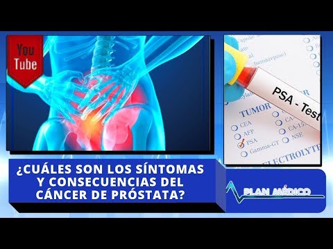 drogas prostatitis síntomas causas y tratamientos drogas prostatitis síntomas causas y tratamientos