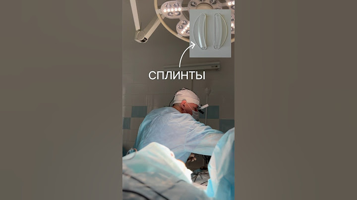 Что такое сплинты ? Для чего нужны силиконовые трубочки после ринопластики ?