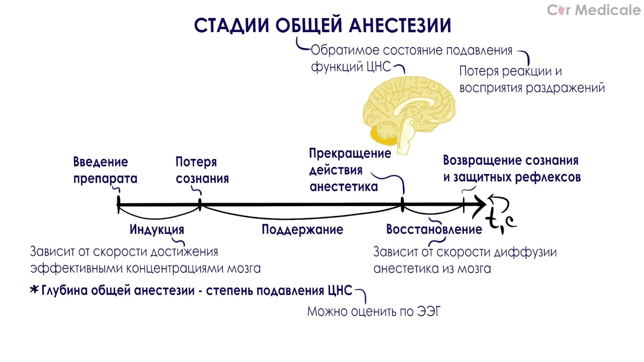 Стадии общей анестезии - Общие и местные анестетики - YouTube