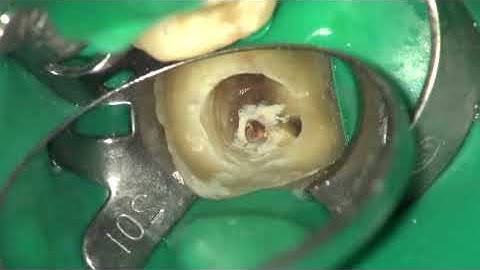 warm vertical compaction