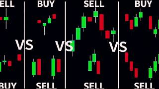 What is Candlestick Chart?| Types & Anatomy | Stock Market for Beginners