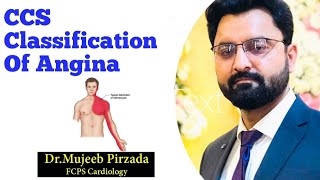 Classification Of Angina| CCS Class Of Angina| By Dr Mujeeb Pirzada Cardiologist