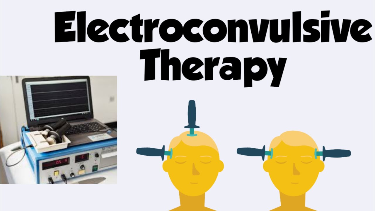 Electroconvulsive Therapy in hindi/ECT Mental Health Nursing / ECT ...