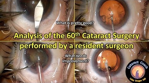 Analysis of the 60th Cataract Surgery performed by a resident surgeon in training