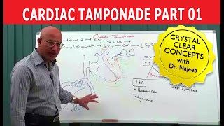 Cardiac Tamponade | Cardiology | Part 1/5