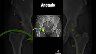 📸 Anatomía radiológica de la pelvis