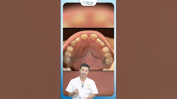 Nong Hàm Niềng Răng| Bác Sĩ Yên