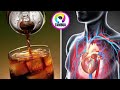 YAJUE MADHARA YA KUTUMIA SODA KATIKA MWILI WAKO 