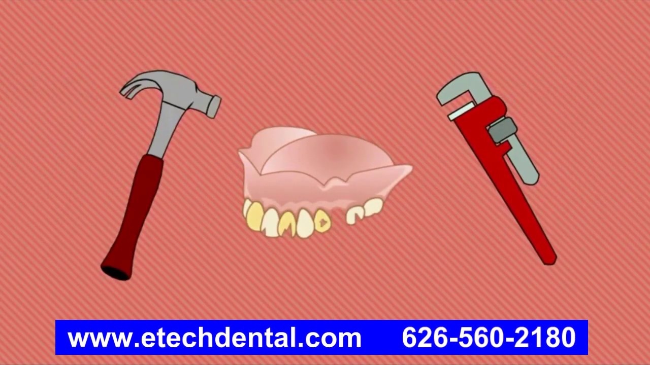Denture Repair, 8 Minute Denture Repair Service YouTube
