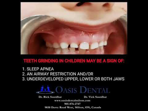 Causes of teeth grinding in Kids &  Children | Sleep Apnea | TMJ Disorder | Narrow Jaw |Bioblock ALF