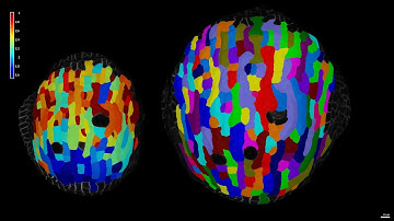 Video 4: Quick segmentation of the 2nd stack