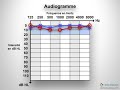 Audiogramme