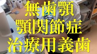 【全部床義歯】有料老人ホーム入居者 無歯顎 顎関節症 患者様へ、治療用義歯の製作 群馬県太田市