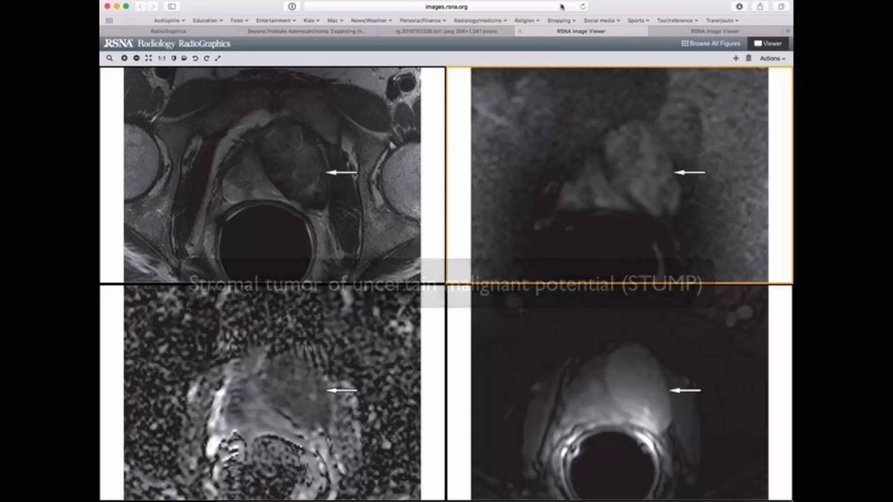 Levitä pillua nuolla