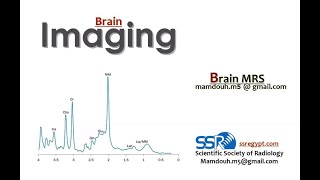 03. Brain MRS ... Prof. Dr. Mamdouah Mahfouz