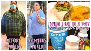 WHAT I EAT IN A DAY AFTER 6 WEEKS OF HAVING GASTRIC BYPASS SURGERY // HOW MUCH WEIGHT HAVE I LOST? screenshot 4