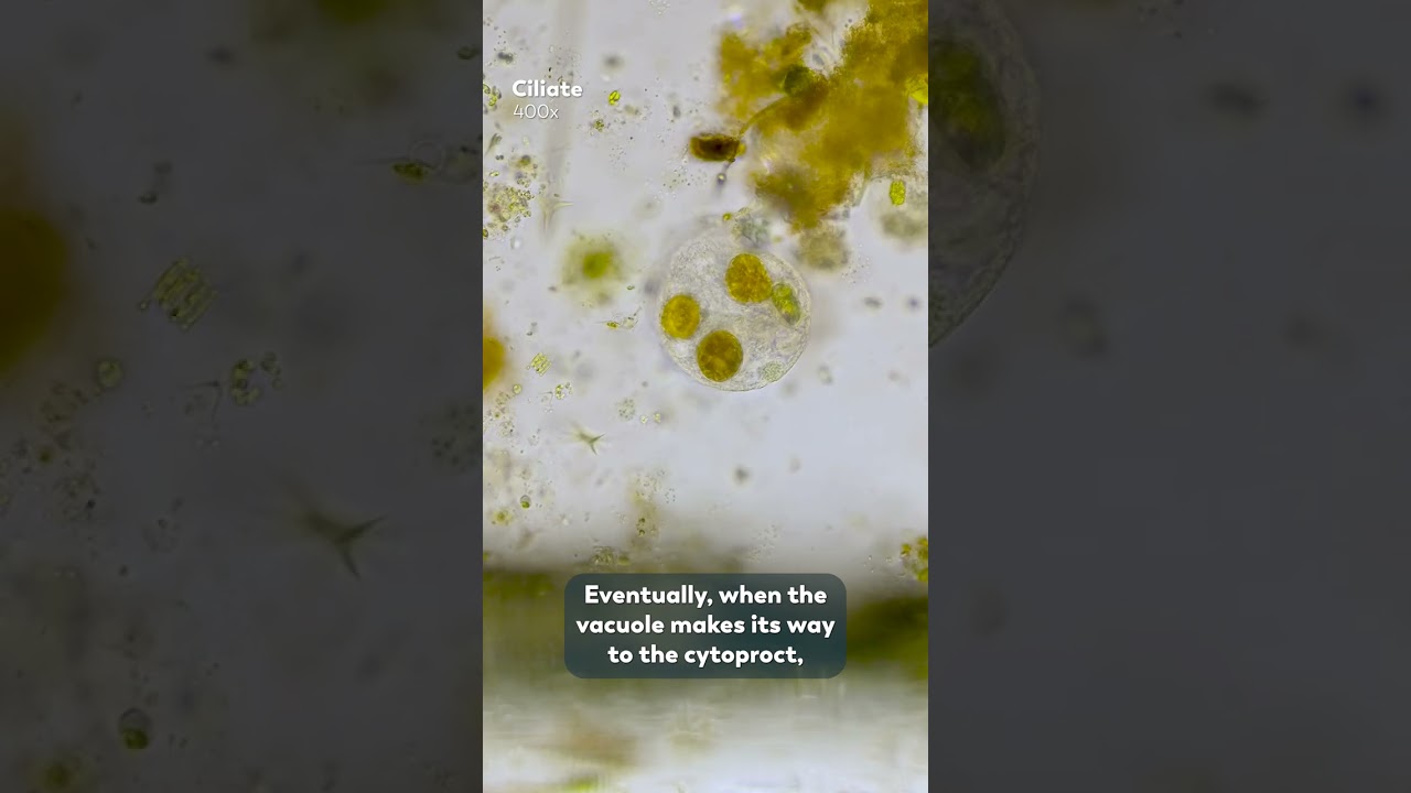 How Do Ciliates Go To The Bathroom?