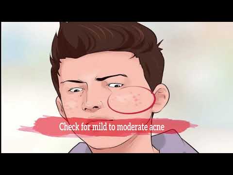 Come sapere se avete raggiunto la pubertà ragazzi