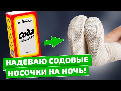 Содовые носочки помогли избавиться от ЭТИХ болезней!